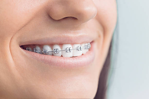 Best Invisalign and Clear Aligners  in Alanuk, AK